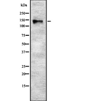 SYNJ2 / Synaptojanin 2 Antibody - Western blot analysis of SYNJ2 using Jurkat whole lysates.