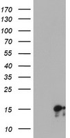 SYNJ2BP / OMP25 Antibody - HEK293T cells were transfected with the pCMV6-ENTRY control (Left lane) or pCMV6-ENTRY SYNJ2BP (Right lane) cDNA for 48 hrs and lysed. Equivalent amounts of cell lysates (5 ug per lane) were separated by SDS-PAGE and immunoblotted with anti-SYNJ2BP.