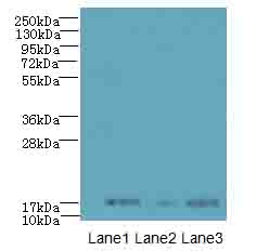 SYNJ2BP / OMP25 Antibody - Western blot. All lanes: SYNJ2BP antibody at 3 ug/ml. Lane 1: MCF7 whole cell lysate. Lane 2: U251 whole cell lysate. Lane 3: Caco-2 whole cell lysate. Secondary Goat polyclonal to Rabbit IgG at 1:10000 dilution. Predicted band size: 16 kDa. Observed band size: 16 kDa.