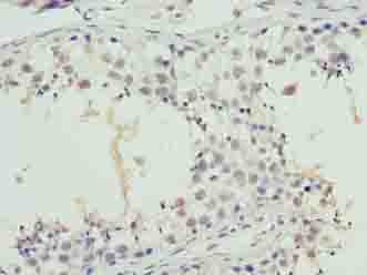 SYNJ2BP / OMP25 Antibody - Immunohistochemistry of paraffin-embedded human testis tissue using antibody at dilution of 1:100.
