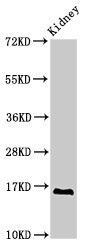 SYNJ2BP / OMP25 Antibody - Western Blot Positive WB detected in: Rat kidney tissue All lanes: SYNJ2BP antibody at 2.8µg/ml Secondary Goat polyclonal to rabbit IgG at 1/50000 dilution Predicted band size: 16 kDa Observed band size: 16 kDa