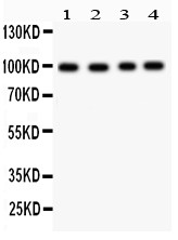 SYNPO / Synaptopodin Antibody - Synaptopodin antibody Western blot. All lanes: Anti Synaptopodin at 0.5 ug/ml. Lane 1: Mouse Brain Tissue Lysate at 50 ug. Lane 2: U87 Whole Cell Lysate at 40 ug. Lane 3: HEPG2 Whole Cell Lysate at 40 ug. Lane 4: 293T Whole Cell Lysate at 40 ug. Predicted band size: 99 kD. Observed band size: 99 kD.