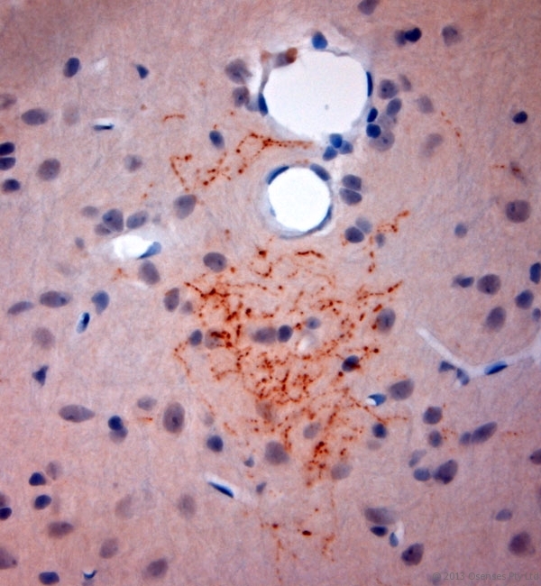 SYNPO / Synaptopodin Antibody - Rabbit antibody to Synaptopodin (890-930). IHC-P on paraffin sections of rat brain. The animal was perfused using Autoperfuser at a pressure of 110 mm Hg with 300 ml 4% FA and further post fixed overnight before being processed for paraffin embedding. HIER: Tris-EDTA, pH 9 for 20 min using Thermo PT Module. Blocking: 0.2% LFDM in TBST filtered through a 0.2 micron filter. Detection was done using Novolink HRP polymer from Leica following manufacturers instructions. Primary antibody: dilution 1:1000, incubated 30 min at RT using Autostainer. Sections were counterstained with Harris Hematoxylin.
