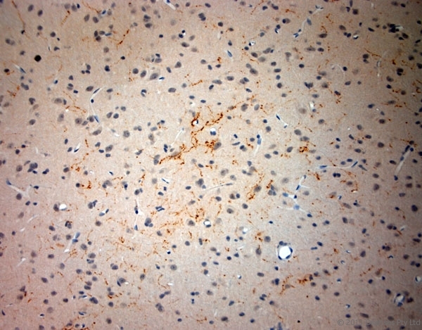 SYNPO / Synaptopodin Antibody - Rabbit antibody to Synaptopodin (890-930). IHC-P on paraffin sections of rat brain. The animal was perfused using Autoperfuser at a pressure of 110 mm Hg with 300 ml 4% FA and further post fixed overnight before being processed for paraffin embedding. HIER: Tris-EDTA, pH 9 for 20 min using Thermo PT Module. Blocking: 0.2% LFDM in TBST filtered through a 0.2 micron filter. Detection was done using Novolink HRP polymer from Leica following manufacturers instructions. Primary antibody: dilution 1:1000, incubated 30 min at RT using Autostainer. Sections were counterstained with Harris Hematoxylin.