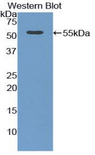 SYNPO / Synaptopodin Antibody - Western blot of recombinant SYNPO / Synaptopodin.  This image was taken for the unconjugated form of this product. Other forms have not been tested.