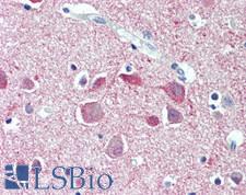 SYNPO / Synaptopodin Antibody - Human Brain, Cortex: Formalin-Fixed, Paraffin-Embedded (FFPE)