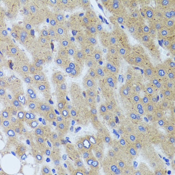 SYNPO / Synaptopodin Antibody - Immunohistochemistry of paraffin-embedded human liver injury tissue.