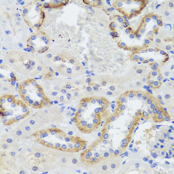 SYNPO / Synaptopodin Antibody - Immunohistochemistry of paraffin-embedded rat kidney tissue.
