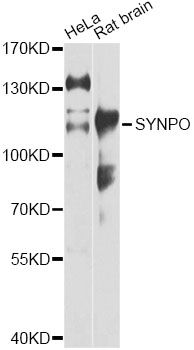 SYNPO / Synaptopodin Antibody - Western blot analysis of extracts of various cell lines, using SYNPO antibody at 1:1000 dilution. The secondary antibody used was an HRP Goat Anti-Rabbit IgG (H+L) at 1:10000 dilution. Lysates were loaded 25ug per lane and 3% nonfat dry milk in TBST was used for blocking. An ECL Kit was used for detection and the exposure time was 5s.
