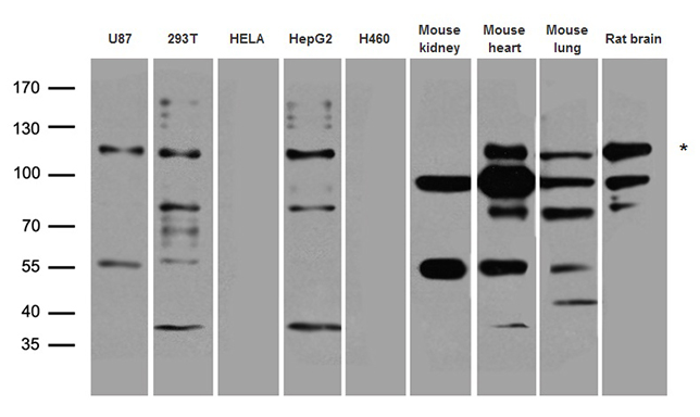 SYNPO / Synaptopodin Antibody - Western blot analysis of extracts. (35ug) from different cell lines and tissues by using anti-SYNPO rabbit polyclonal antibody.