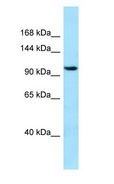 SYNPO2 / Synaptopodin 2 Antibody - SYNPO2 / Synaptopodin 2 antibody Western Blot of 721_B.  This image was taken for the unconjugated form of this product. Other forms have not been tested.