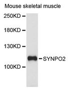 SYNPO2 / Synaptopodin 2 Antibody - Western blot analysis of extracts of mouse skeletal muscle, using SYNPO2 antibody at 1:3000 dilution. The secondary antibody used was an HRP Goat Anti-Rabbit IgG (H+L) at 1:10000 dilution. Lysates were loaded 25ug per lane and 3% nonfat dry milk in TBST was used for blocking. An ECL Kit was used for detection and the exposure time was 90s.
