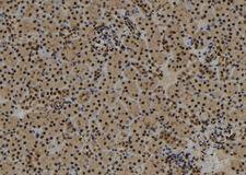 SYNPO2 / Synaptopodin 2 Antibody - 1:100 staining mouse kidney tissue by IHC-P. The sample was formaldehyde fixed and a heat mediated antigen retrieval step in citrate buffer was performed. The sample was then blocked and incubated with the antibody for 1.5 hours at 22°C. An HRP conjugated goat anti-rabbit antibody was used as the secondary.