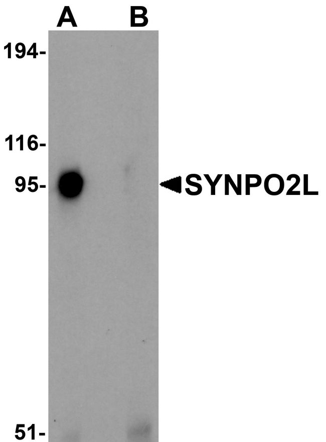 SYNPO2L Antibody - Western blot analysis of SYNPO2L in human thymus tissue lysate with SYNPO2L antibody at 1 ug/ml in (A) the absence and (B) the presence of blocking peptide.