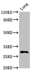 SYNPR / Synaptoporin Antibody - Western Blot Positive WB detected in: Rat lung tissue All lanes: SYNPR antibody at 3µg/ml Secondary Goat polyclonal to rabbit IgG at 1/50000 dilution Predicted band size: 30, 32 kDa Observed band size: 30 kDa