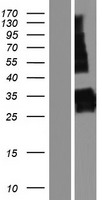 SYNPR / Synaptoporin Protein - Western validation with an anti-DDK antibody * L: Control HEK293 lysate R: Over-expression lysate