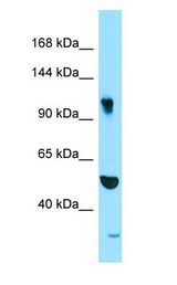 SYNRG Antibody - SYNRG antibody Western Blot of PANC1.  This image was taken for the unconjugated form of this product. Other forms have not been tested.