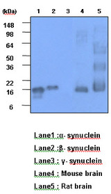 Synuclein Alpha + Beta Antibody - The recombinant protein (20ng) and tissue lysates (30ug) were resolved by SDS-PAGE, transferred to PVDF membrane and probed with anti-human a,ß-Synuclein antibody (1:1000). Proteins were visualized using a goat anti-mouse secondary antibody conjugated to HRP and an ECL detection system.