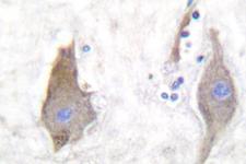 Synuclein Antibody - IHC of Synuclein-pan (A19) pAb in paraffin-embedded human brain tissue.