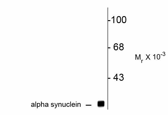 Synuclein Antibody - Western Blot of SNCA antibody. Western blot of rat brain lysate showing specific immunolabeling of ~ 15k alpha synuclein protein