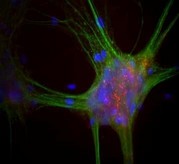 Synuclein Antibody - Immunofluorescent staining using SNCA antibody. Mixed neuron-glial cultures stained with alpha-synuclein (red) and chicken MAP2 (green)
