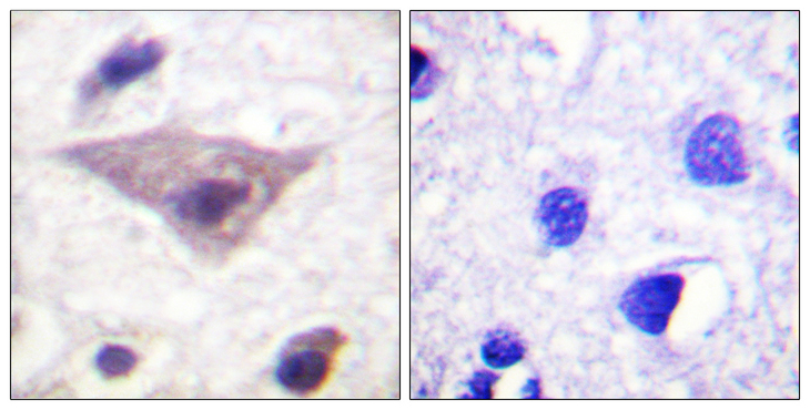 Synuclein Antibody - Immunohistochemistry analysis of paraffin-embedded human brain, using Synuclein (Phospho-Ser129) Antibody. The picture on the right is blocked with the phospho peptide.