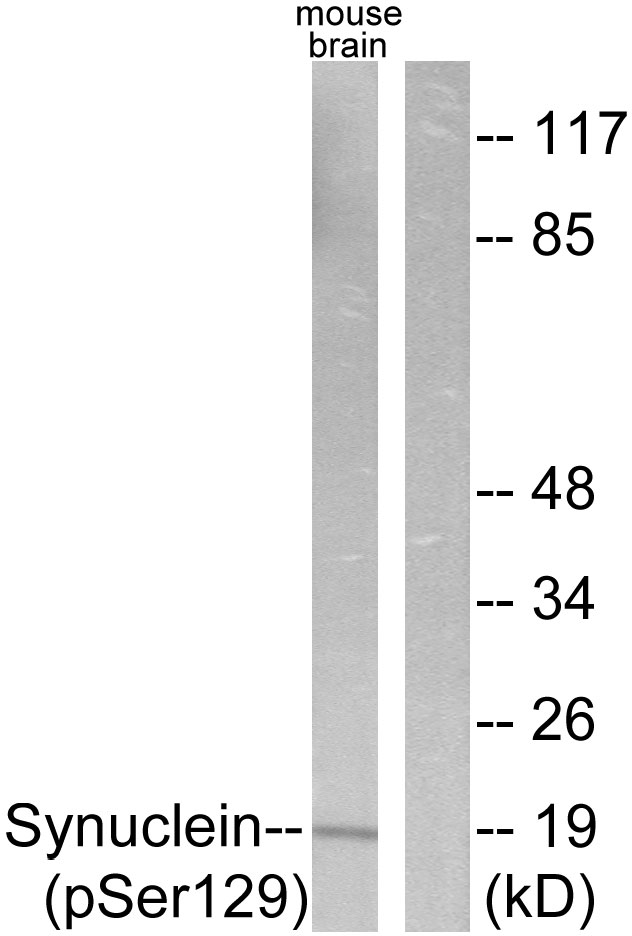 Synuclein Antibody - Western blot analysis of lysates from mouse brain, using Synuclein (Phospho-Ser129) Antibody. The lane on the right is blocked with the phospho peptide.