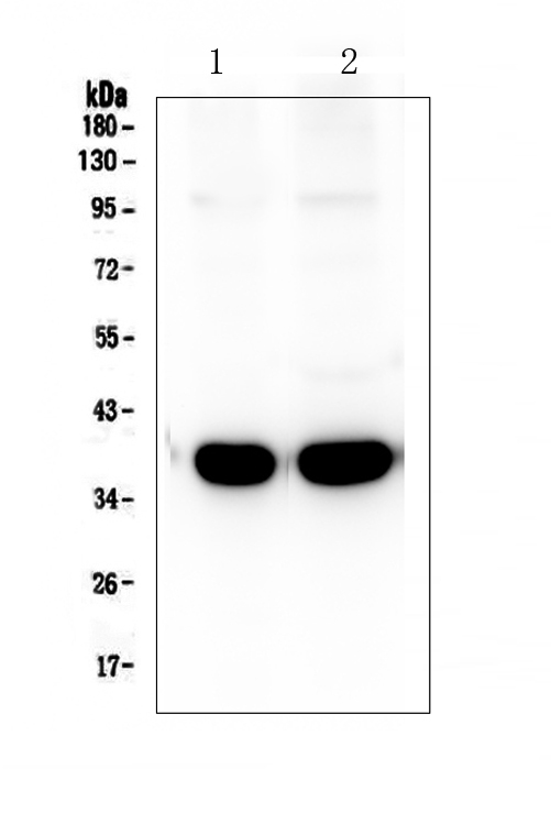 SYP / Synaptophysin Antibody - Western blot analysis of Synaptophysin using anti-Synaptophysin antibody. Electrophoresis was performed on a 5-20% SDS-PAGE gel at 70V (Stacking gel) / 90V (Resolving gel) for 2-3 hours. The sample well of each lane was loaded with 50ug of sample under reducing conditions. Lane 1: rat brain tissue lysates, Lane 2: mouse brain tissue lysates. After Electrophoresis, proteins were transferred to a Nitrocellulose membrane at 150mA for 50-90 minutes. Blocked the membrane with 5% Non-fat Milk/ TBS for 1.5 hour at RT. The membrane was incubated with rabbit anti-Synaptophysin antigen affinity purified polyclonal antibody at 0.5 µg/mL overnight at 4°C, then washed with TBS-0.1% Tween 3 times with 5 minutes each and probed with a goat anti-rabbit IgG-HRP secondary antibody at a dilution of 1:10000 for 1.5 hour at RT. The signal is developed using an Enhanced Chemiluminescent detection (ECL) kit with Tanon 5200 system. A specific band was detected for Synaptophysin at approximately 38KD. The expected band size for Synaptophysin is at 34KD.