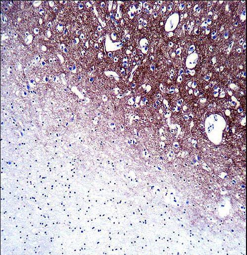SYP / Synaptophysin Antibody - SYP Antibody immunohistochemistry of formalin-fixed and paraffin-embedded human brain tissue followed by peroxidase-conjugated secondary antibody and DAB staining.