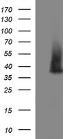 SYP / Synaptophysin Antibody - HEK293T cells were transfected with the pCMV6-ENTRY control (Left lane) or pCMV6-ENTRY SYP (Right lane) cDNA for 48 hrs and lysed. Equivalent amounts of cell lysates (5 ug per lane) were separated by SDS-PAGE and immunoblotted with anti-SYP.