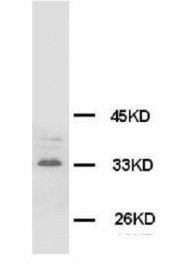 SYP / Synaptophysin Antibody -  This image was taken for the unconjugated form of this product. Other forms have not been tested.