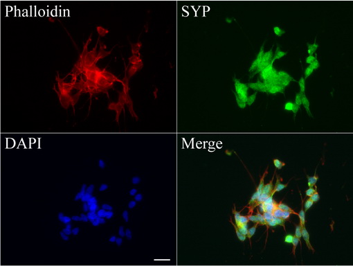 SYP / Synaptophysin Antibody - Immunofluorescent staining of SH-SY5Y cells using anti-SYP mouse monoclonal antibody  green, 1:100). Actin filaments were labeled with Alexa Fluor® 594 Phalloidin. (red), and nuclear with DAPI. (blue). Scale bar, 20µm.