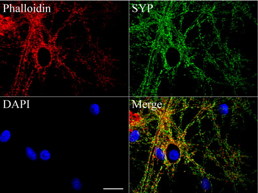 SYP / Synaptophysin Antibody - Confocal immunofluoresce image of primary rat neurons labeled with anti-SYP mouse monoclonal antibody  green, 1:100). Actin filaments were labeled with TRICT-Phalloidin. (red), and nuclear with DAPI. (blue). Scale bar, 20um.