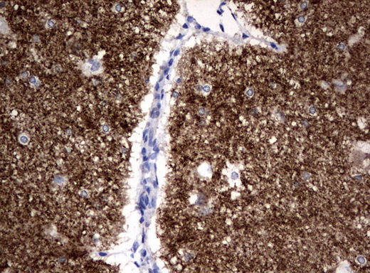 SYP / Synaptophysin Antibody - Immunohistochemical staining of paraffin-embedded Human adult brain tissue using anti-SYP mouse monoclonal antibody.  heat-induced epitope retrieval by 10mM citric buffer, pH6.0, 120C for 3min)