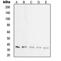 SYP / Synaptophysin Antibody - Western blot analysis of Synaptophysin expression in HeLa (A); SP2/0 (B); mouse brain (C); rat brain (D); PC12 (E) whole cell lysates.