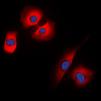 SYP / Synaptophysin Antibody - Immunofluorescent analysis of Synaptophysin staining in HeLa cells. Formalin-fixed cells were permeabilized with 0.1% Triton X-100 in TBS for 5-10 minutes and blocked with 3% BSA-PBS for 30 minutes at room temperature. Cells were probed with the primary antibody in 3% BSA-PBS and incubated overnight at 4 C in a humidified chamber. Cells were washed with PBST and incubated with a DyLight 594-conjugated secondary antibody (red) in PBS at room temperature in the dark. DAPI was used to stain the cell nuclei (blue).