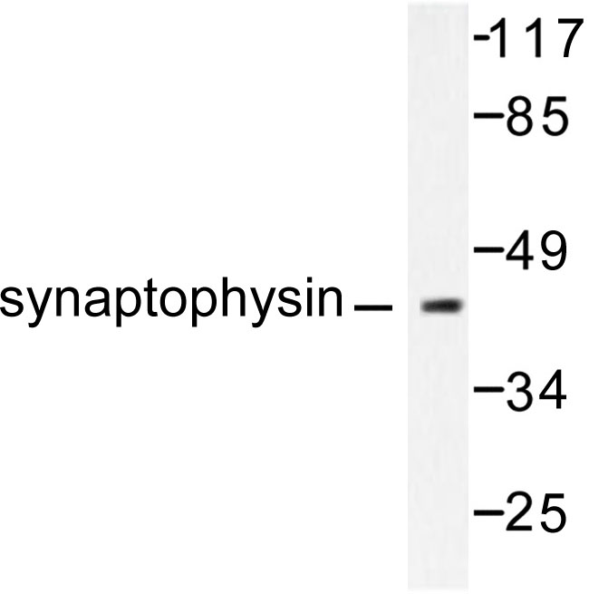 SYP / Synaptophysin Antibody - Western blot of Synaptophysin (L128) pAb in extracts from LOVO cells.