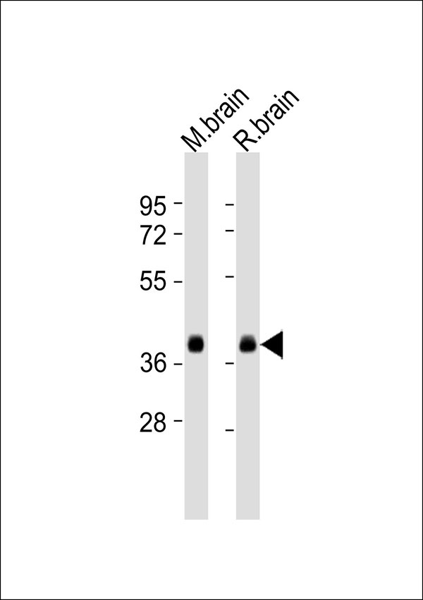 SYP / Synaptophysin Antibody - All lanes : Anti-Synaptophysin Antibody at 1:1000 dilution Lane 1: mouse brain lysates Lane 2: rat brain lysates Lysates/proteins at 20 ug per lane. Secondary Goat Anti-Rabbit IgG, (H+L),Peroxidase conjugated at 1/10000 dilution Predicted band size : 34 kDa Blocking/Dilution buffer: 5% NFDM/TBST.