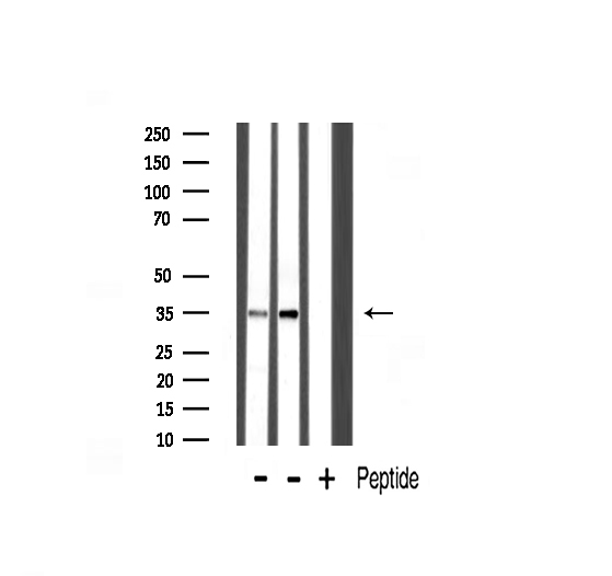 SYP / Synaptophysin Antibody - Western blot analysis of Synaptophysin expression in various lysates