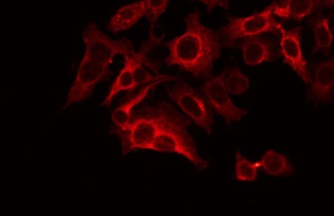 SYP / Synaptophysin Antibody - Staining LOVO cells by IF/ICC. The samples were fixed with PFA and permeabilized in 0.1% Triton X-100, then blocked in 10% serum for 45 min at 25°C. The primary antibody was diluted at 1:200 and incubated with the sample for 1 hour at 37°C. An Alexa Fluor 594 conjugated goat anti-rabbit IgG (H+L) Ab, diluted at 1/600, was used as the secondary antibody.