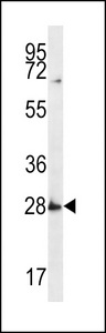 SYPL1 Antibody - SYPL1 Antibody western blot of MDA-MB231 cell line lysates (35 ug/lane). The SYPL1 antibody detected the SYPL1 protein (arrow).