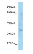SYPL1 Antibody - SYPL1 antibody Western Blot of Fetal Thymus.  This image was taken for the unconjugated form of this product. Other forms have not been tested.