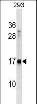 SYS1 Antibody - SYS1 Antibody western blot of 293 cell line lysates (35 ug/lane). The SYS1 antibody detected the SYS1 protein (arrow).