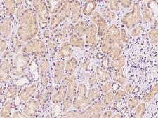 SYS1 Antibody - Immunochemical staining of human SYS1 in human kidney with rabbit polyclonal antibody at 1:100 dilution, formalin-fixed paraffin embedded sections.