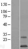 SYS1 Protein - Western validation with an anti-DDK antibody * L: Control HEK293 lysate R: Over-expression lysate