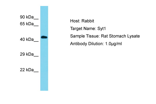 SYT1 / Synaptotagmin Antibody -  This image was taken for the unconjugated form of this product. Other forms have not been tested.