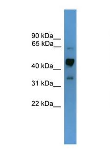 SYT1 / Synaptotagmin Antibody - SYT1 / Synaptotagmin antibody Western blot of Mouse Spleen lysate. Antibody concentration 1 ug/ml.  This image was taken for the unconjugated form of this product. Other forms have not been tested.