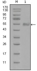 SYT1 / Synaptotagmin Antibody - Western blot using SYT1 mouse monoclonal antibody against truncated Trx-SYT1 recombinant protein (1).