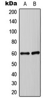 SYT1 / Synaptotagmin Antibody - Western blot analysis of Synaptotagmin expression in HEK293T (A); Jurkat (B) whole cell lysates.