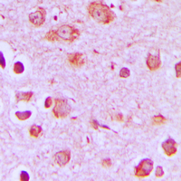 SYT1 / Synaptotagmin Antibody - Immunohistochemical analysis of Synaptotagmin staining in human brain formalin fixed paraffin embedded tissue section. The section was pre-treated using heat mediated antigen retrieval with sodium citrate buffer (pH 6.0). The section was then incubated with the antibody at room temperature and detected using an HRP conjugated compact polymer system. DAB was used as the chromogen. The section was then counterstained with hematoxylin and mounted with DPX.